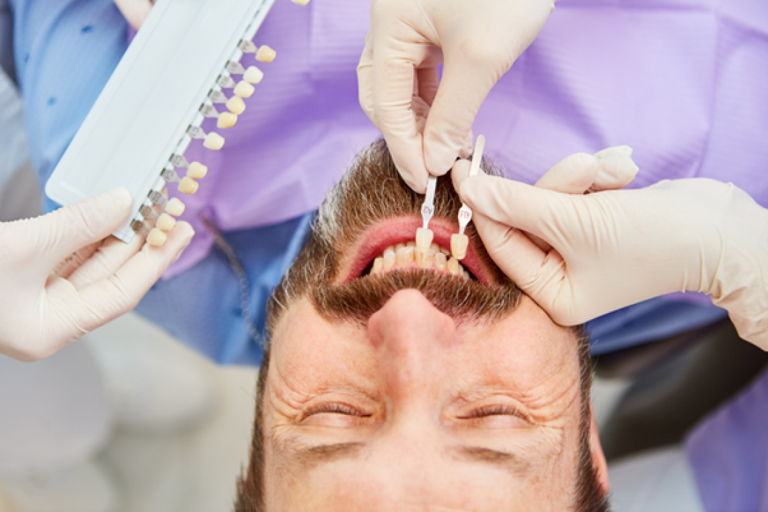 How To Get The Smile Of Your Dreams With Veneers